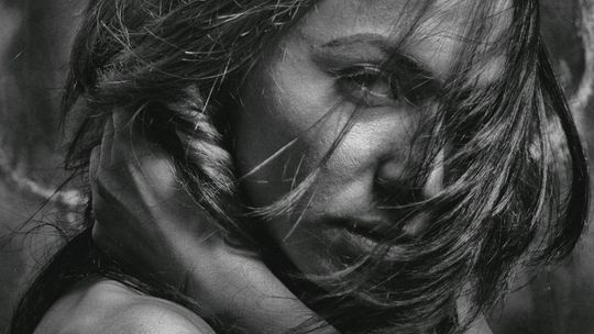 Jak zapobiegać wypadaniu włosów w łojotokowym zapaleniu skóry?