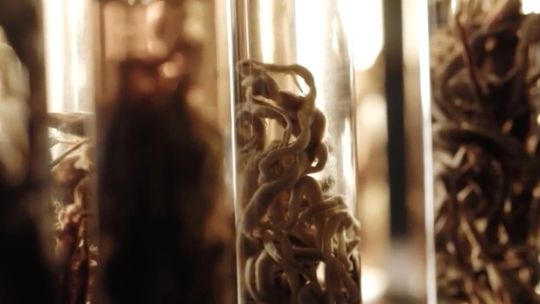 «Zmarli Nagle»: Skutki uboczne i nagłe zgony, czyli FILM bojkotowany przez System